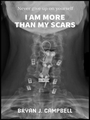 cover image of I Am More Than My Scars — Never Give Up On Yourself